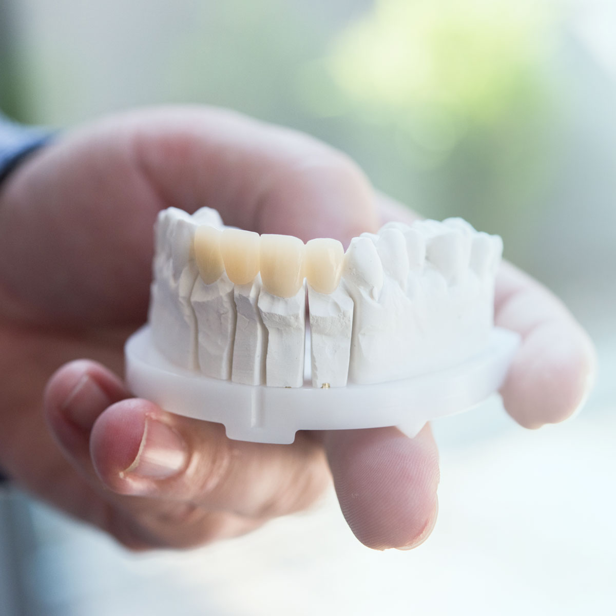 We want to keep your own teeth for as long as possible